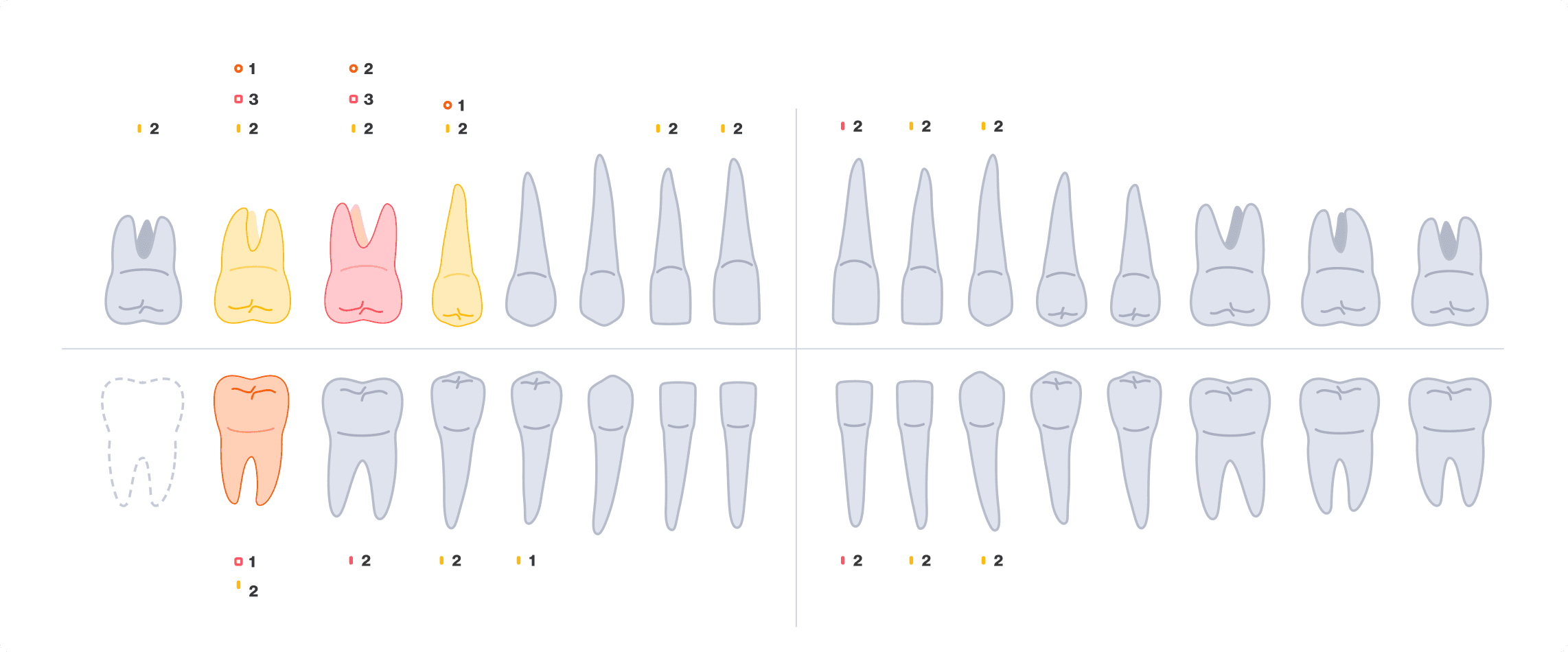 Early odontogram line-drawing with color-coded severity indicators