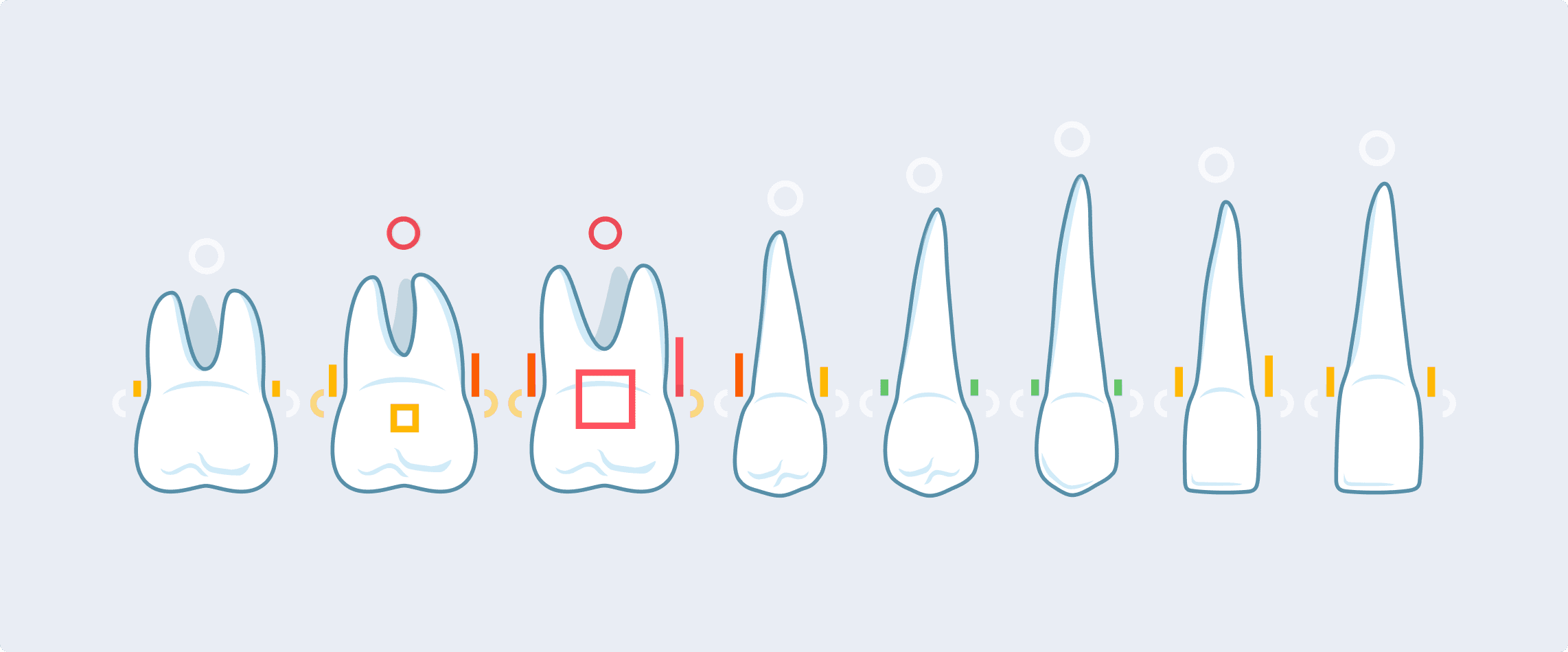 Simplified outline odontogram with anatomical adjustments
