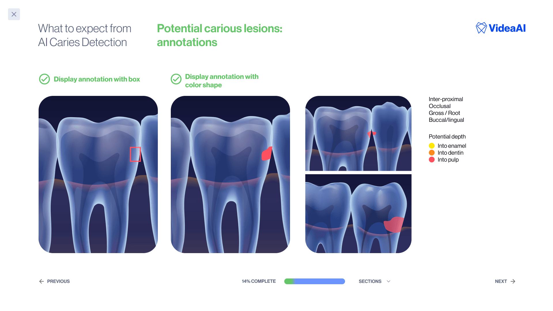 Onboarding slide — caries detection annotations