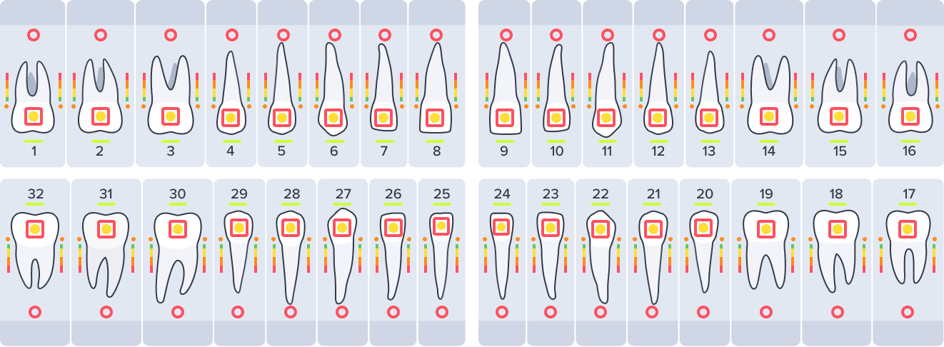 Detail view of odontogram indicators for various dental findings