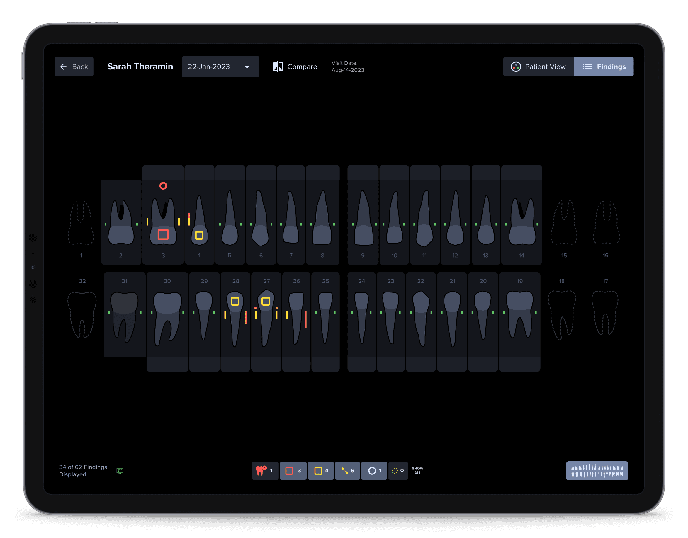 Odontogram integrated into the VideaHealth product