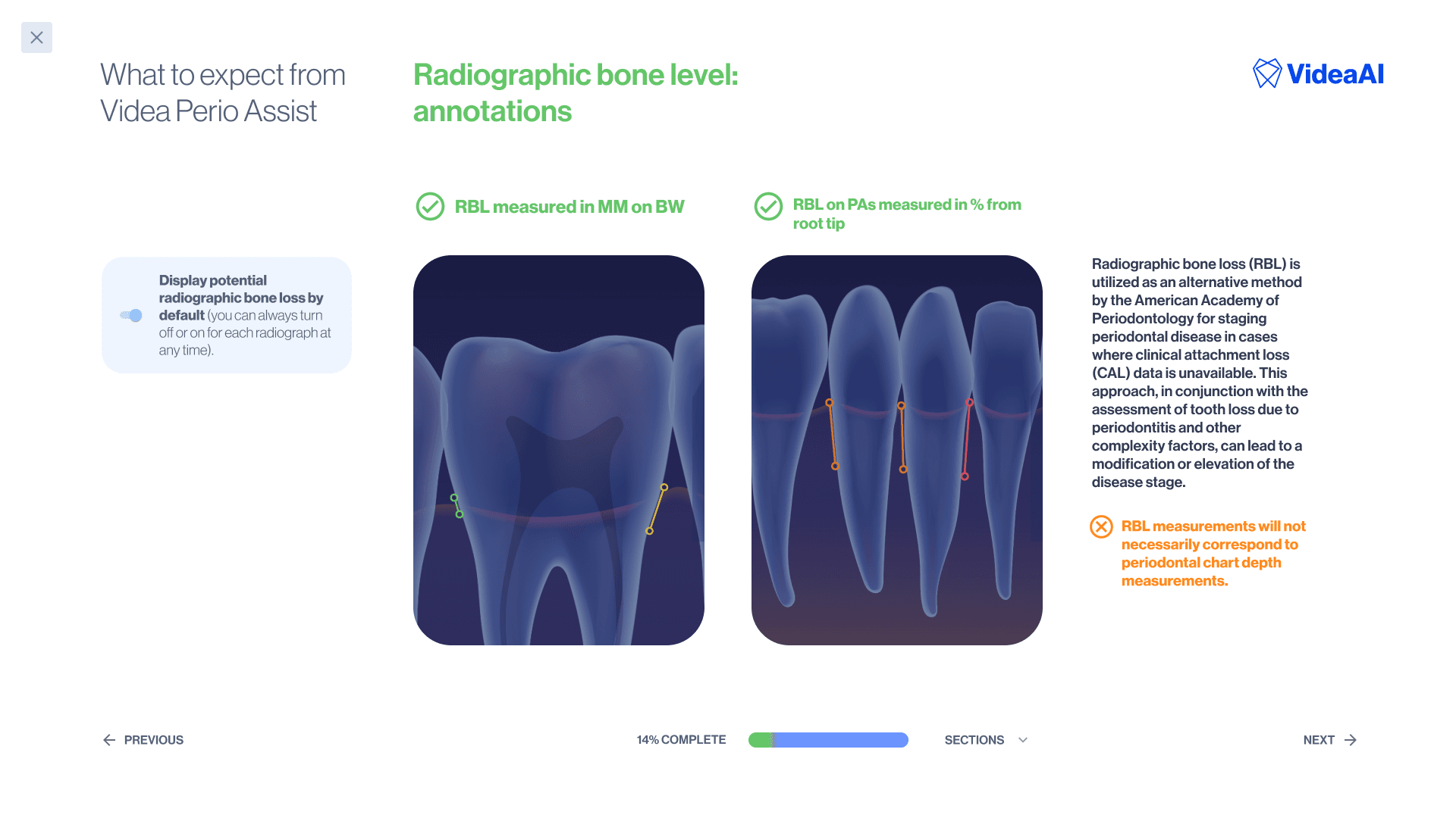 Onboarding slide — radiographic bone loss detection